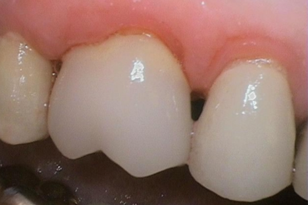 cc12