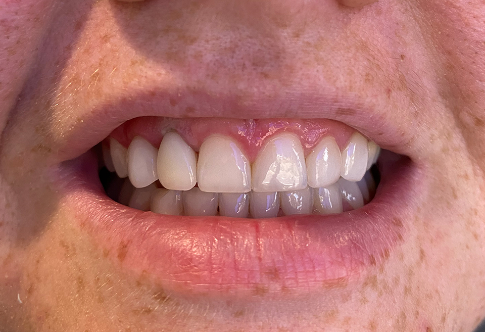 cc12
