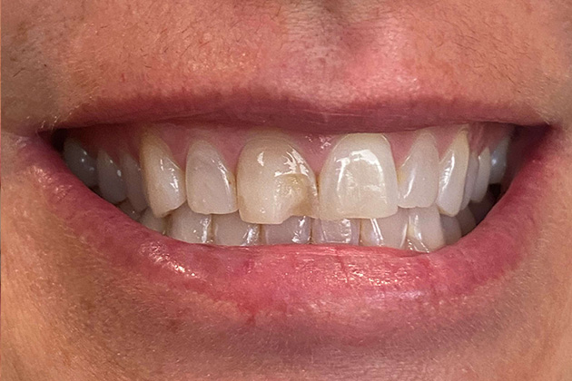 cc11